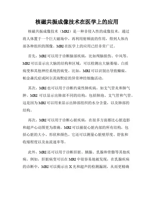 核磁共振成像技术在医学上的应用
