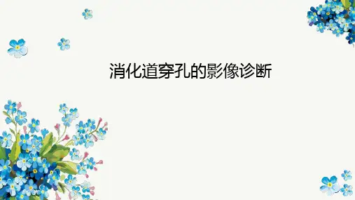 消化道穿孔的影像诊断与鉴别诊断