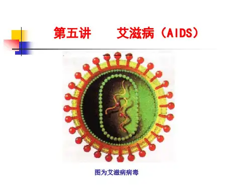 艾滋病