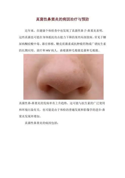 真菌性鼻窦炎的病因治疗与预防