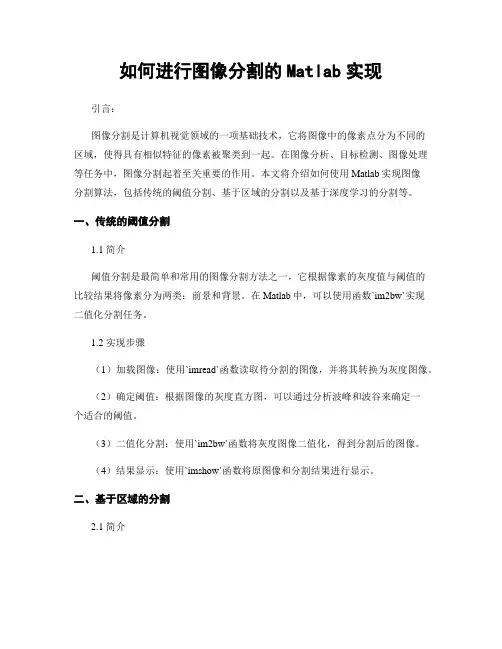 如何进行图像分割的Matlab实现