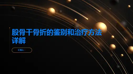 股骨干骨折的鉴别和治疗方法详解