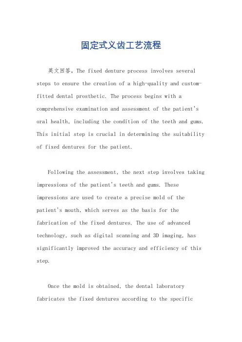 固定式义齿工艺流程