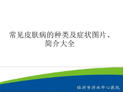 常见皮肤病的种类及症状图片简介大全