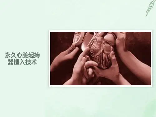 永久心脏起搏器植入技术
