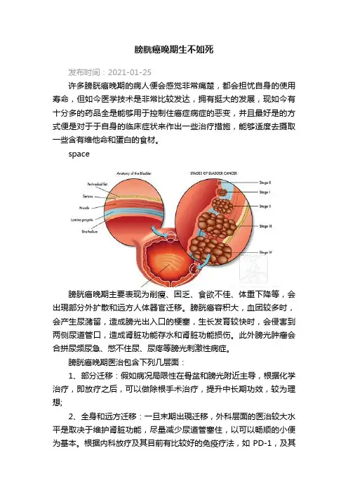 膀胱癌晚期生不如死