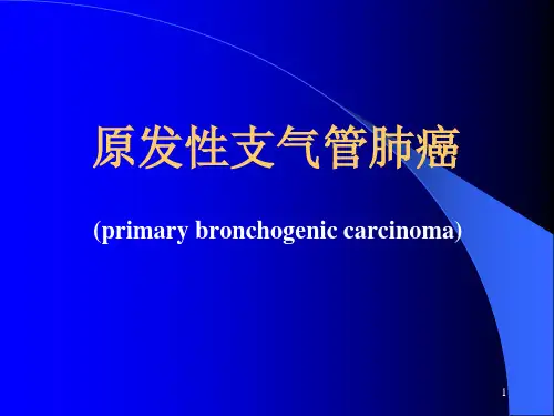 肺癌讲稿
