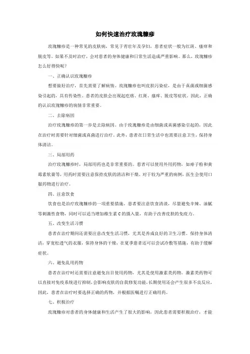 如何快速治疗玫瑰糠疹