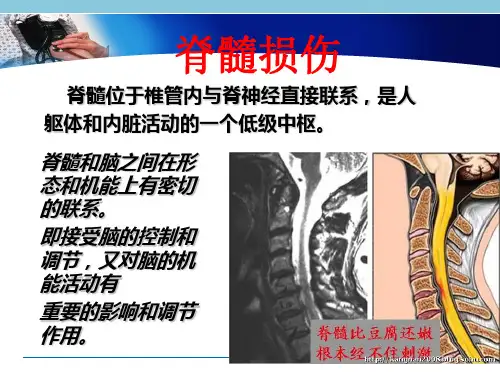 颈脊髓损伤患者的护理查房_PPT课件