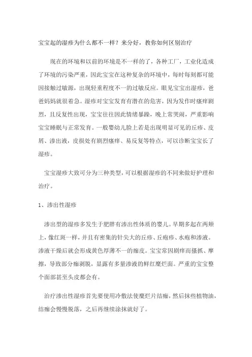 宝宝起的湿疹为什么都不一样？来分好,教你如何区别治疗