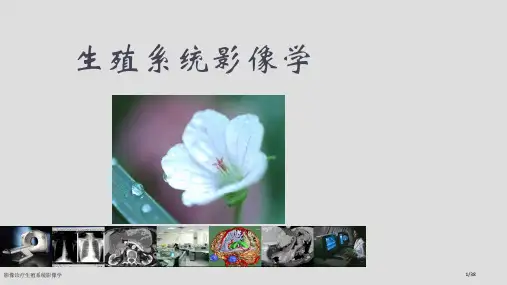 影像诊疗生殖系统影像学