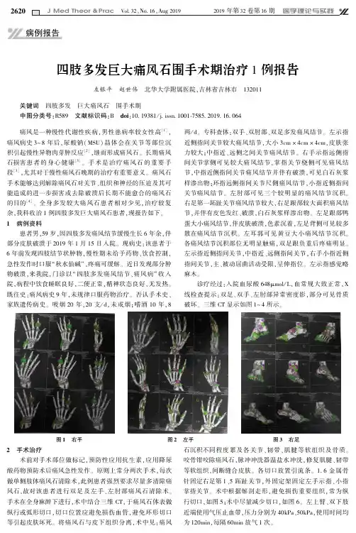 四肢多发巨大痛风石围手术期治疗1例报告