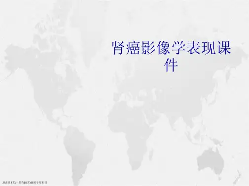 肾癌影像学表现详解