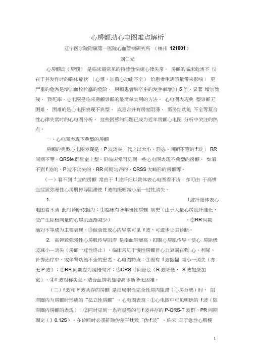 心房颤动心电图难点解析