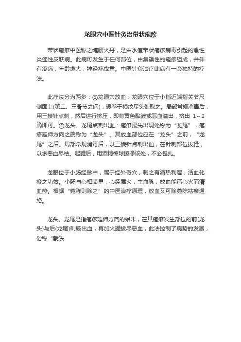 龙眼穴中医针灸治带状疱疹