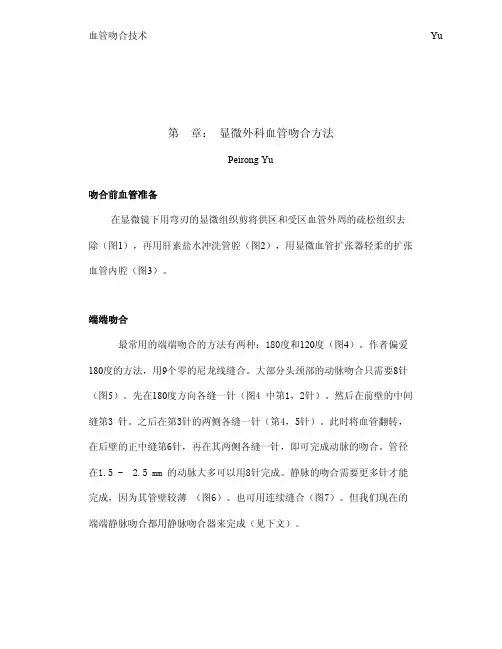 血管吻合技术