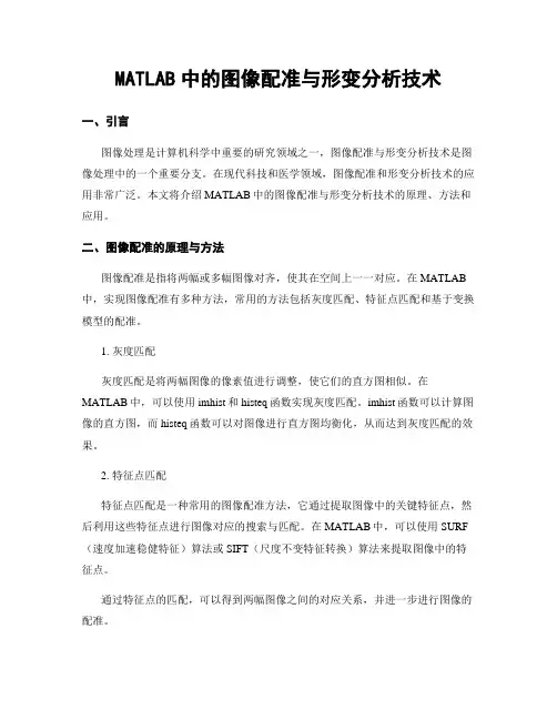 MATLAB中的图像配准与形变分析技术