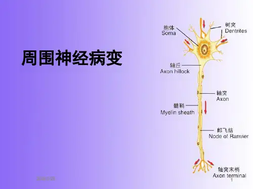 周围神经病变PPT课件