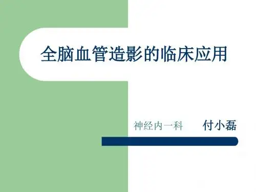 全脑血管造影术ppt课件