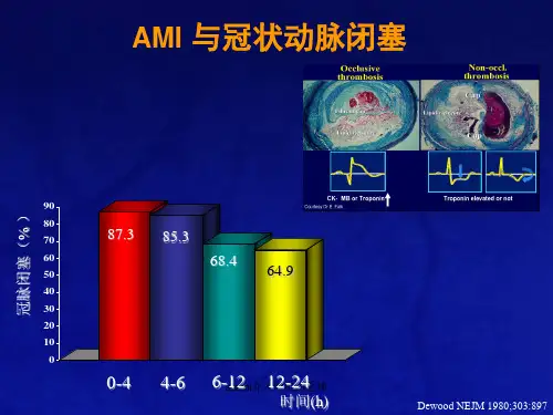 stemi介入时机的选择课件