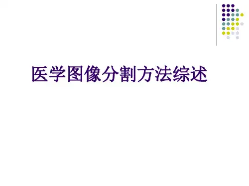 医学图像分割方法综述