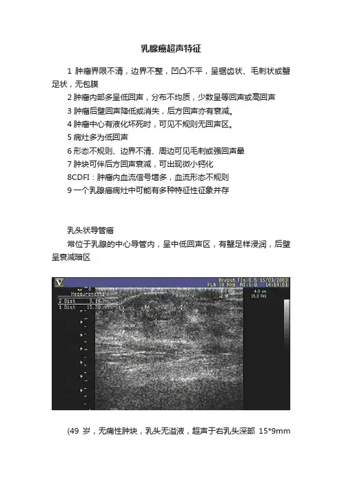 乳腺癌超声特征