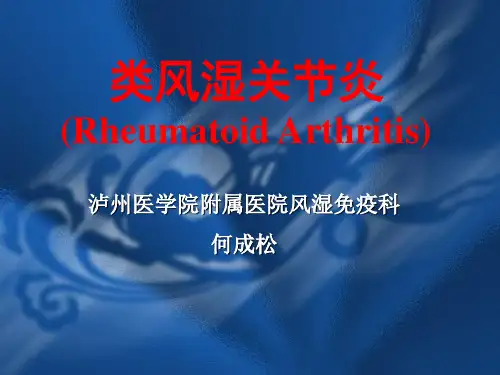 类风关