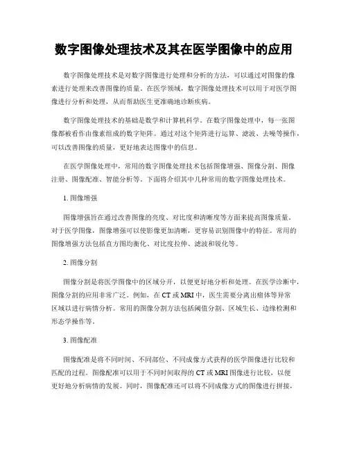 数字图像处理技术及其在医学图像中的应用