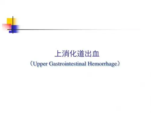 2016上消化道出血临床指南