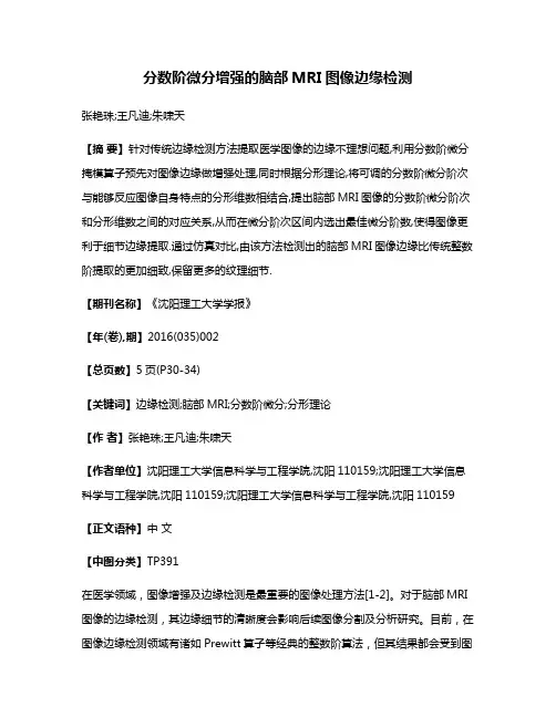 分数阶微分增强的脑部MRI图像边缘检测