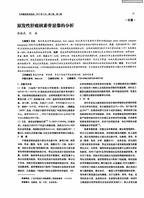 原发性肝癌核素骨显像的分析