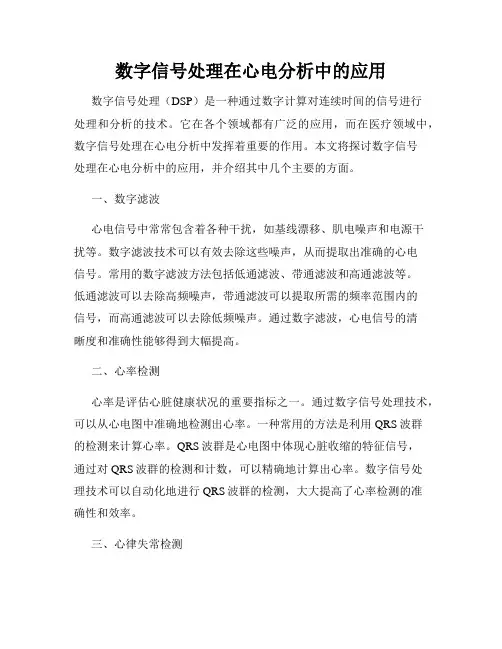 数字信号处理在心电分析中的应用