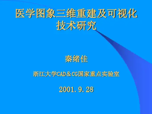 医学图象三维重建及可视化技术研究