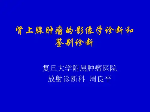 肾上腺肿瘤