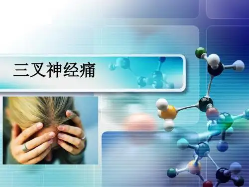 三叉神经痛
