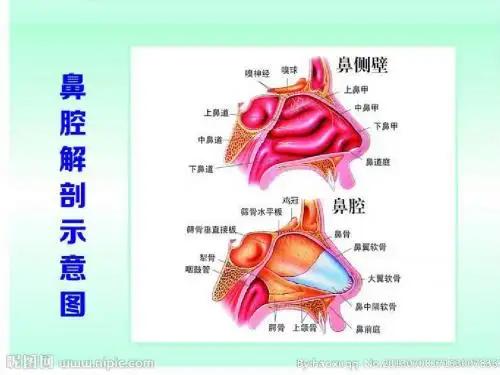 鼻内镜手术
