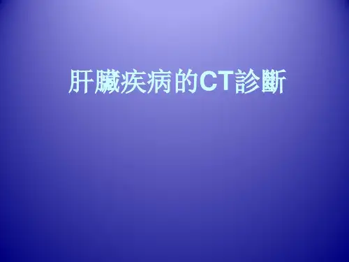 肝脏疾病的CT诊断  PPT课件