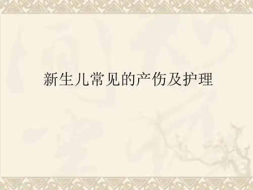 新生儿常见的产伤及护理  ppt课件