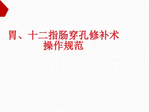 消化道穿孔修补术操作规范