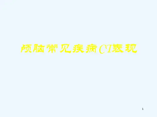 颅脑常见疾病CT表现