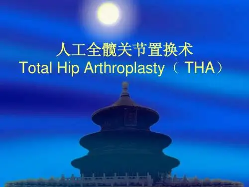 人工全髋关节置换