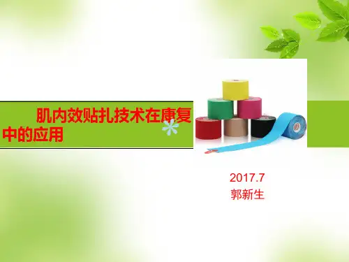 肌内效贴技术