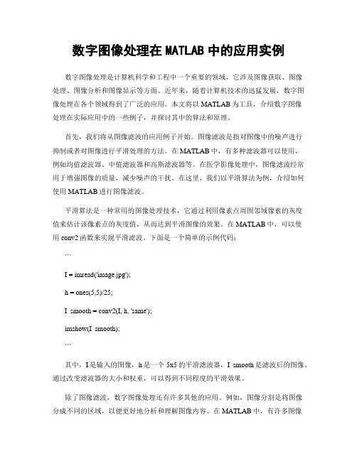 数字图像处理在MATLAB中的应用实例