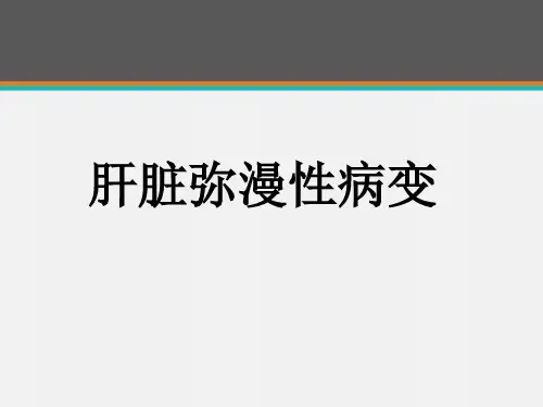 肝脏弥漫性病变 ppt课件
