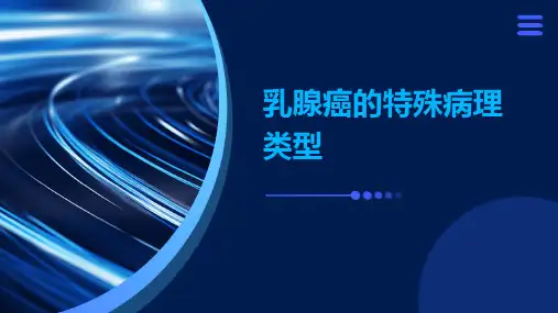 乳腺癌的特殊病理类型