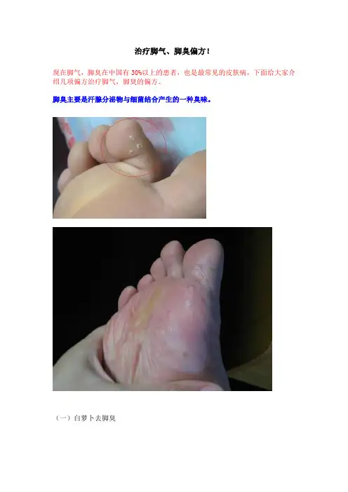 治脚气方子