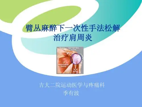 肩周炎