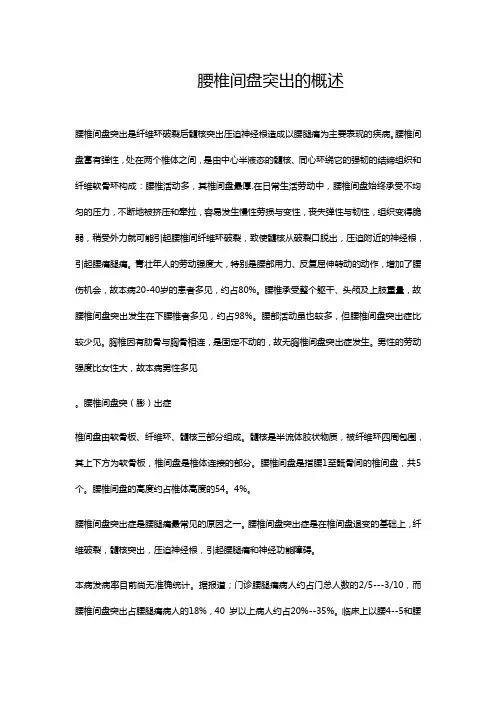 腰椎间盘突出的概述