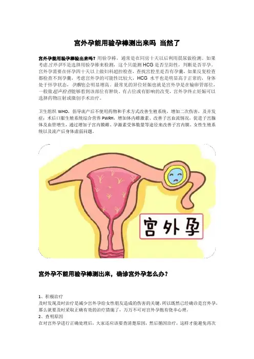 宫外孕能用验孕棒测出来吗 当然了