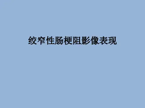 绞窄性肠梗阻的影像学表现